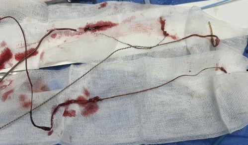 成人能使用口外弓吗视频,口外弓在成人中的应用与技巧揭秘