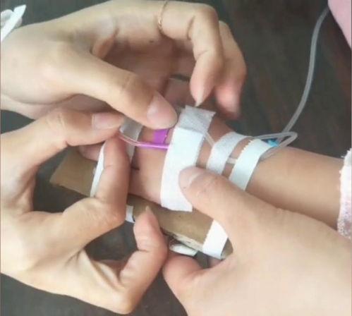 成人黑管的包扎方法视频,视频教程详解